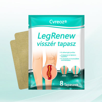 Cvreoz® LegRenew visszér tapasz javítja a vénák egészségét és megszünteti a visszereket🌿Nincs tű, nincs műtét, csak biztonságos, gyengéd és hatékony eredmény✨✨