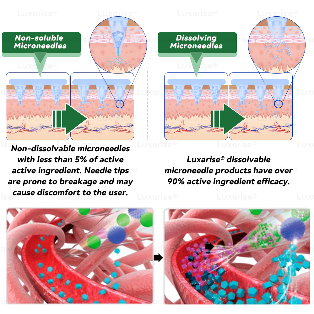 FDA-Registered & GMP Certified 👩‍⚕️ 𝑳𝒖𝒙𝒂𝒓𝒊𝒔𝒆® 𝑴𝒐𝒓𝒊𝒏𝒈𝒂 & 𝑩𝒆𝒓𝒃𝒆𝒓𝒊𝒏𝒆 10-𝑰𝑵-1 𝑨𝒅𝒗𝒂𝒏𝒄𝒆𝒅 𝑵𝒂𝒏𝒐 𝑴𝒊𝒄𝒓𝒐𝒏𝒆𝒆𝒅𝒍𝒆 𝑷𝒂𝒕𝒄𝒉 💎(𝐎𝐧𝐜𝐞 𝐃𝐚𝐢𝐥𝐲, 𝐯𝐢𝐬𝐢𝐛𝐥𝐞 𝐜𝐡𝐚𝐧𝐠𝐞𝐬 𝐢𝐧 𝟕 𝐝𝐚𝐲𝐬）✅ 𝐎𝐛𝐞𝐬𝐢𝐭𝐲, 𝐃𝐢𝐚𝐛𝐞𝐭𝐞𝐬, 𝐒𝐥𝐞𝐞𝐩 𝐀𝐩𝐧𝐞𝐚, 𝐀𝐧𝐝 𝐉𝐨𝐢𝐧𝐭 𝐈𝐬𝐬𝐮𝐞𝐬