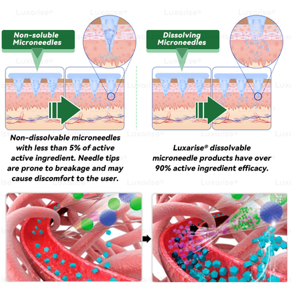 FDA-Registered & GMP Certified 👩‍⚕️ 𝑳𝒖𝒙𝒂𝒓𝒊𝒔𝒆® 𝑴𝒐𝒓𝒊𝒏𝒈𝒂 & 𝑩𝒆𝒓𝒃𝒆𝒓𝒊𝒏𝒆 10-𝑰𝑵-1 𝑨𝒅𝒗𝒂𝒏𝒄𝒆𝒅 𝑵𝒂𝒏𝒐 𝑴𝒊𝒄𝒓𝒐𝒏𝒆𝒆𝒅𝒍𝒆 𝑷𝒂𝒕𝒄𝒉 💎(𝐎𝐧𝐜𝐞 𝐃𝐚𝐢𝐥𝐲, 𝐯𝐢𝐬𝐢𝐛𝐥𝐞 𝐜𝐡𝐚𝐧𝐠𝐞𝐬 𝐢𝐧 𝟕 𝐝𝐚𝐲𝐬）✅ 𝐎𝐛𝐞𝐬𝐢𝐭𝐲, 𝐃𝐢𝐚𝐛𝐞𝐭𝐞𝐬, 𝐒𝐥𝐞𝐞𝐩 𝐀𝐩𝐧𝐞𝐚, 𝐀𝐧𝐝 𝐉𝐨𝐢𝐧𝐭 𝐈𝐬𝐬𝐮𝐞𝐬
