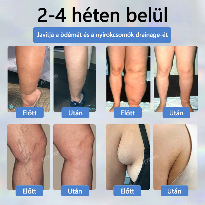 Cvreoz® Fekete kömény Ödéma méregtelenítő gyógynövénykrém - a gyors, látható enyhülés érdekében🍃🍃