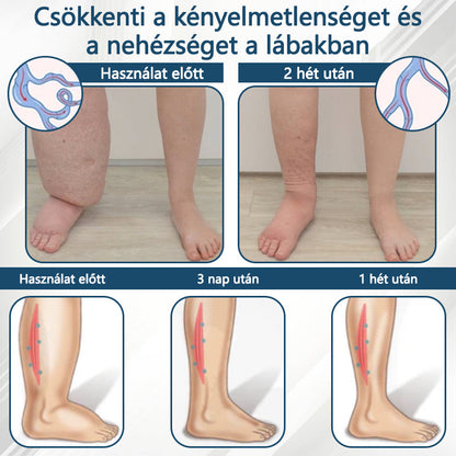 Cvreoz® Fekete kömény Ödéma méregtelenítő gyógynövénykrém - a gyors, látható enyhülés érdekében🍃🍃
