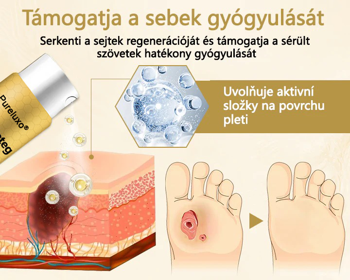 Pureluxo® méhméreg gyógyító spray a sebek gyógyulására és regenerálására a kezeken és a lábakon🌿