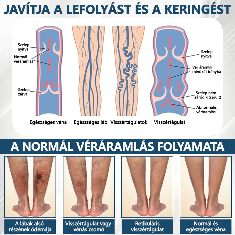 Cvreoz® Fekete kömény Ödéma méregtelenítő gyógynövénykrém - a gyors, látható enyhülés érdekében🍃🍃