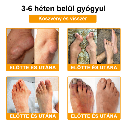 Pureluxo® Botulinum Toxin és Méhméreg Fájdalomcsillapító Csontgyógyító Krém🐝🌿 (Kifejezetten időseknek & ortopéd szakorvosok ajánlásával)🔥🔥🔥🔥🔥