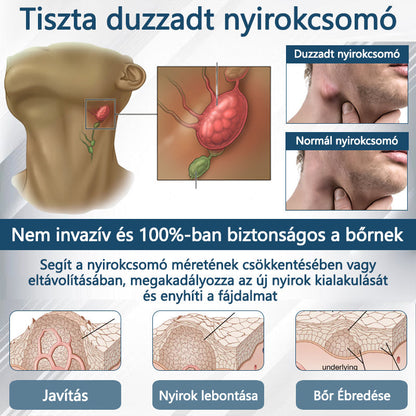 Cvreoz® Fekete kömény Ödéma méregtelenítő gyógynövénykrém - a gyors, látható enyhülés érdekében🍃🍃